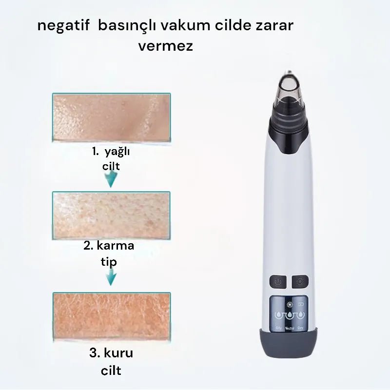 Siyah Nokta Temizleyici Elektrikli - MAKKA